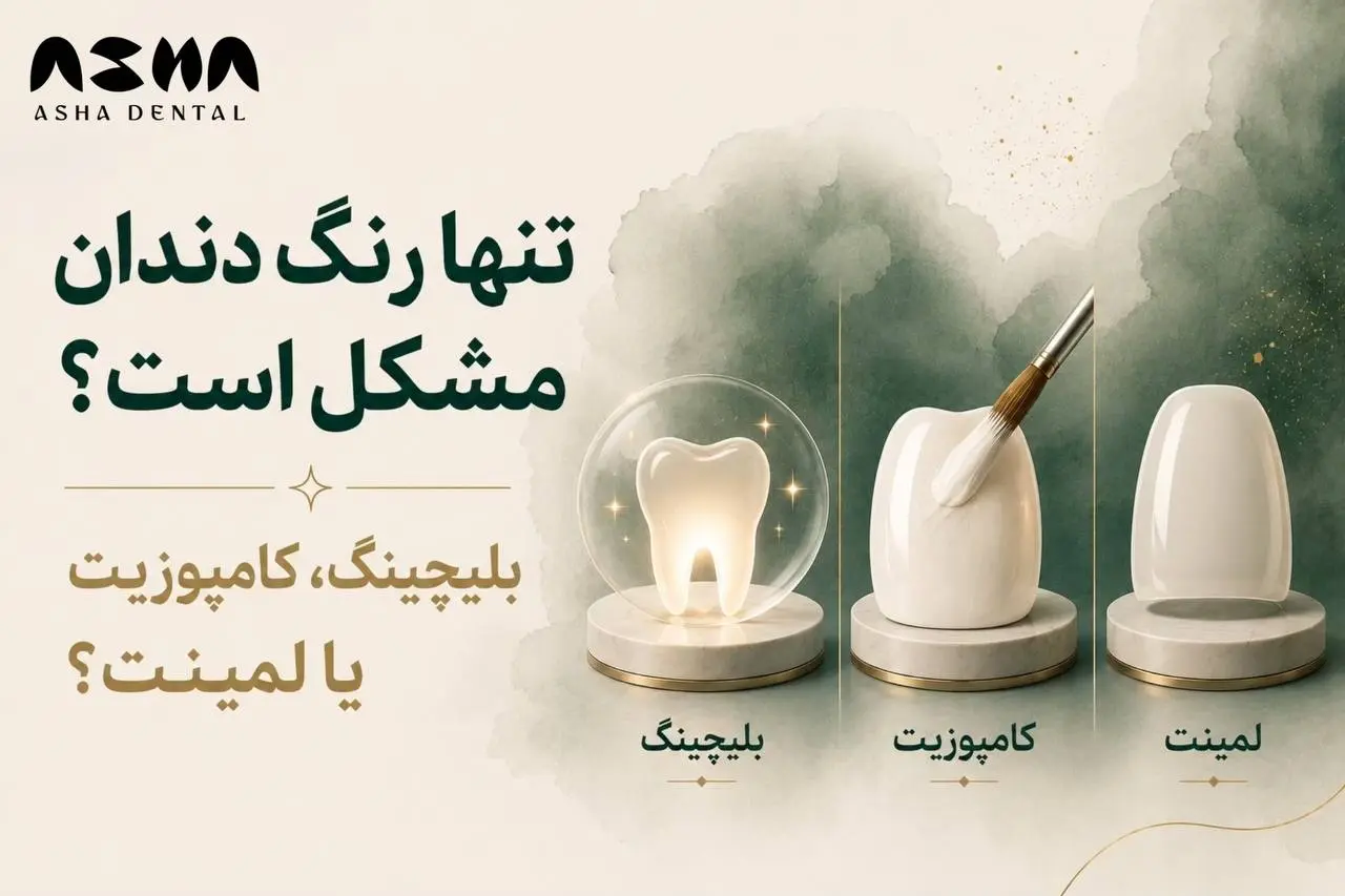 بهترین روش طراحی لبخند