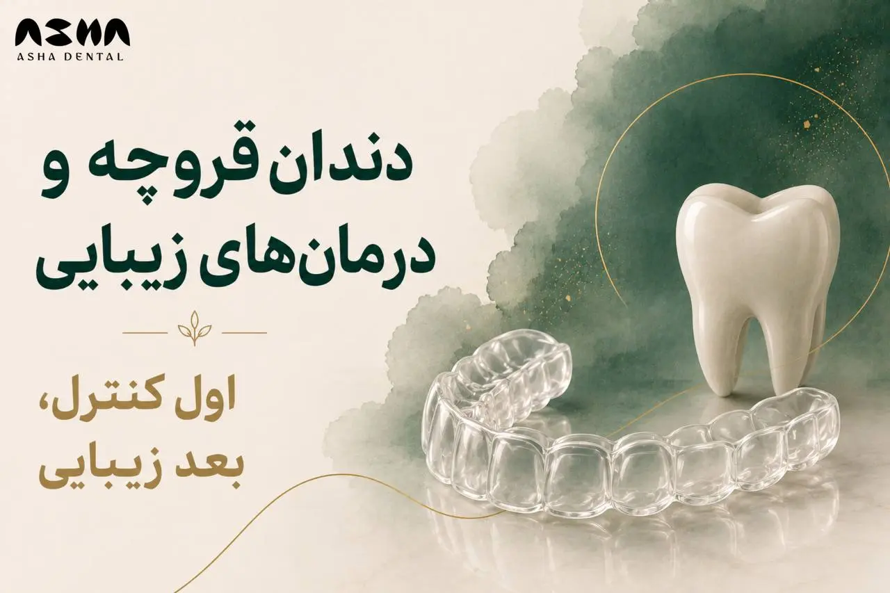 چگونه بهترین روش طراحی لبخند را انتخاب کنیم