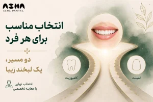 تفاوت کامپوزیت و لمینت